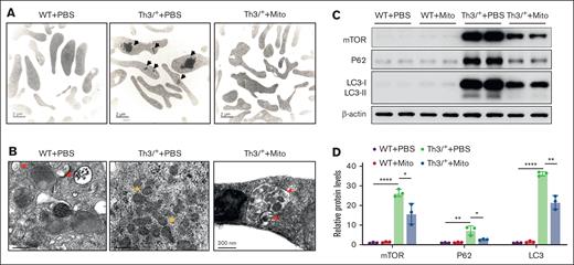Mitoxantrone promoted autophagy in reticulocytes of β-thalassemia mice. (A) Globin precipitates (indicated by black arrows) in enriched reticulocytes analyzed by transmission electron microscopy (TEM). Scare bars, 2 μm. (B) Mitochondria in enriched reticulocytes analyzed by TEM. Red arrows indicate damaged mitochondria within double-membrane structures. Orange arrows indicate naked intact mitochondria. Scare bars, 200 nm. (C) Representative images of western blot assay for mTOR, p62, and LC3 protein expression in enriched reticulocytes. β-actin was used as a loading control. (D) Densitometric analysis of protein levels detected above using ImageJ software. The groups (n = 4-6 mice, respectively) mean WT and HbbTh3/+ (Th3/+) mice treated with either PBS or mitoxantrone. The bar plot represents the mean ± SD of samples. ∗P < .05; ∗∗P < .01; ∗∗∗∗P < .0001.