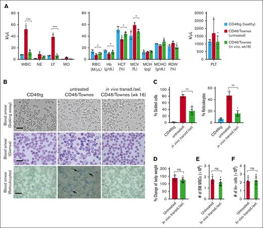 Phenotypic correction after WU-106/AMD3100 mobilization and in vivo HSC prime–editing blood analyses. (A) Complete blood cell count using week 16 samples after in vivo transduction (n = 7). Blood samples from healthy CD46.tg mice (n = 3) and untreated CD46/Townes mice (n = 4) were used as the controls. For comparisons of multiple groups, 1-way and 2-way ANOVA with Bonferroni posttest for multiple comparisons was used. Statistical analysis was performed using GraphPad Prism version 10.0.3. ∗∗∗P ≤ .001, ∗∗P ≤ .01, ∗P ≤ .05. (B) Representative microphotographs of the blood cell smears from week 16 samples. First panel: smears of total blood cells subjected to a sickling assay; second panel: blood cell smears stained with Giemsa; third panel: staining of blood smears for reticulocytes with brilliant cresyl blue, which stains nuclear remnants of basophilic ribonucleoproteins in reticulocytes (black arrow). The scale bars are 20 μm. (C) Upper panel: percentage of sickle cells in the blood smears. Each dot represents the percentage in an individual mouse. Lower panel: percentage of reticulocytes in blood smears. (D-F) Comparisons of body weight (D), number of BM MNCs (E), and number of Lin– cells in untreated and in vivo transduced animals. ns, not significant.