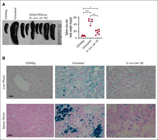 Phenotypic correction after WU-106/AMD3100 mobilization and in vivo HSC prime editing: spleen and liver analyses. (A) Spleen size (left panel) and spleen weight relative to the body weight (right panel). Each symbol represents an individual mouse. Two-way ANOVA with Bonferroni posttest for multiple comparisons was used. Statistical analysis was performed using GraphPad Prism version 10.0.3. ∗∗∗P ≤ .001, ∗∗P ≤ .01, ∗P ≤ .05. (B) Hemosiderosis: spleen and liver sections stained with Perl Prussian blue. Iron deposition is shown as the cytoplasmic blue pigments of hemosiderin in the spleen tissue sections. The scale bars are 20μm.