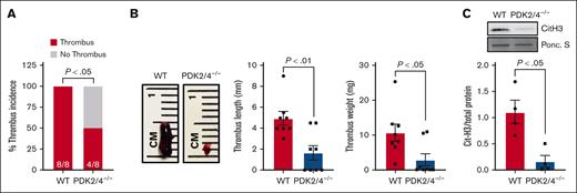 The combined deletion of PDK2/4 inhibits acute DVT. (A) Thrombus incidence in male PDK2/4–/– mice and WT mice 48 hours after IVC stenosis; n = 8 mice per group. Statistical analysis was performed using Fisher exact test. (B) The representative image of IVC thrombus harvested from PDK2/4–/– mice and WT mice 48 hours after IVC stenosis. The bar graphs show quantified mean thrombus weight and thrombus length. Values are mean ± SEM, n = 8 mice per group. Statistical analysis was performed using Mann-Whitney U test. (C) The level of Cit-H3 was measured in the thrombus isolated from PDK2/4–/– mice and WT mice 48 hours after IVC stenosis. A representative western blot for Cit-H3 is shown. Ponceau S (Ponc. S) staining was used as a loading control. The bar graphs show densitometry analysis of immunoblots. Values are mean ± SEM, with n = 4 mice per group. Statistical analysis was performed using Mann-Whitney U test.