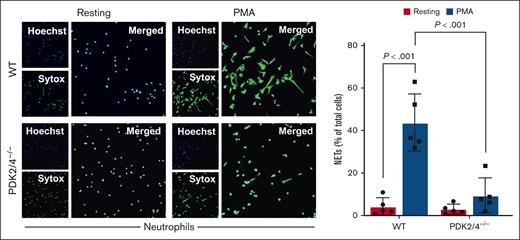 PDK2/4–/– neutrophils exhibit reduced release of NETs. NETs assay was performed by stimulating bone marrow–derived WT and PDK2/4–/– neutrophils with PMA (10 nM) for 4 hours. Representative microphotographs of NETs stained with Sytox green (stains extracellular DNA, green) and counterstained with Hoechst (stains nuclei, blue) are shown. The bar graph shows the quantification of the percentage of cells releasing NETs. Values are mean ± SEM, n = 5 mice per group. Two different fields at 20× magnification were used to estimate the number of neutrophils releasing NETs, which was expressed as a percentage of total neutrophils (coverslip edges were avoided). Statistical analysis was performed using 2-way analysis of variance (ANOVA) followed by Tukey multiple comparisons test.