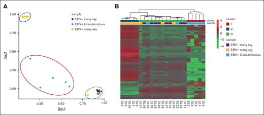 PCA and heat map showed 3 clusters of BL. PCA (A) and heat map (B) revealed the presence of 3 distinct clusters. Cluster 1 consisted of the 5 BL with a diffuse granulomatous reaction (blue), cluster 2 had 5 EBV+ BL with typical starry sky pattern (orange), and cluster 3 includes 8 EBV– BL with typical starry sky (violet), 2 cases of BL with a partial granulomatous reaction, and 3 cases of EBV+ BL with typical starry sky. Heat map visualizing the expression levels of immune-related genes (rows) in each BL sample (column). Upregulated or downregulated genes were selected for subsequent analysis if their expression values were found to exceed an adjusted P value cutoff of <.05, after multiple testing correction using a moderated t statistic.