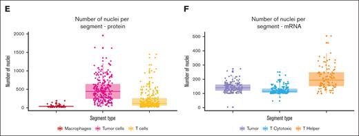 Study overview. Number of patients, number of cell specific segments for (A) protein or (B) mRNA analysis, and number of patients and tissue cores used for (C) image analysis and downstream extraction of spatial metrics. (D) The number of segments per patient is shown in the plot. The nuclear count per segment (area of illumination/area of interest) is shown for the protein workflow (E) and for the RNA workflow (F).
