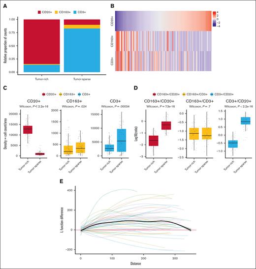 Analysis of the MCL TIME composition using 4-plex IF–based image analysis shows that the distribution of cells varies between spatial regions, but CD3+ to CD163+ cell ratios remain constant. (A) CD20+ cells (tumor), CD163+ cells (macrophages), and CD3+ cells (T cells) in tumor-rich and tumor-sparse ROIs (99 patients, 191 tissue cores). (B) Heat map showing the distribution of cell density (cell counts per area) for the 3 cell types in the tumor-rich region. (C) Box plot comparison of the cell densities (cell counts per area) in tumor-rich and tumor-sparse regions for each of the 3 cell subtypes (63 patients, 98 tissue cores). (D) Box plot comparison of the cell-to-cell ratios in paired samples in which both tumor-rich and tumor-sparse regions were collected in the same patients (34 patients, 51 tissue cores), showing identical CD163+ macrophage to T-cell ratios between the 2 regions. The y-axis is log10 transformed for better visualization. Note that all analyses that compared the distributions and ratios were performed per tissue core but were validated per patient using the mean patient aggregate values (data not shown). (E) A spatial point pattern analysis33 plot that shows the difference in L function value for CD163+ macrophages in tumor-sparse and tumor-rich regions using paired samples (34 patients, 51 tissue cores). The colored lines show tissue-specific L function differences between the 2 spatial regions, and the bold black line shows the average L function difference across all tissue. A clustered pattern is suggested when the average L function value is above 0 with the range of 0 to 50 μm being most important.