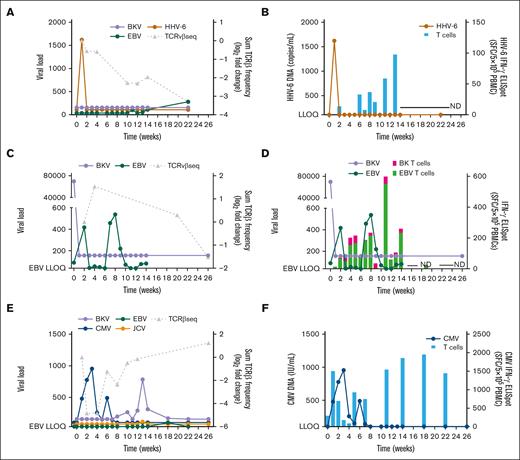 Detection of functional immune reconstitution and posoleucel clones over time coincident with viremia reduction. Patient examples of viral load plotted with unique posoleucel clones detected by TCRβ sequencing (left panels) and functional IFN-γ+ virus-specific T-cell responses detected by ELISpot (posoleucel and endogenous derived; right panels) through week 26 of the study for patients with viremia of ≥1 target virus(es). Three patients with viremia that did not progress to CSI are shown: patient 1: BKV, EBV, and HHV-6 viremia (A-B; received all 7 doses of posoleucel); patient 2: BKV and EBV viremia (C-D; received all 7 doses of posoleucel); and patient 3: BKV, CMV, EBV, and JCV viremia (E-F; received all 7 doses of posoleucel). TCRβ clones unique to posoleucel are shown as the log2 fold change of the sum frequency of clones relative to first time point detected. Virus-specific IFN-γ+–producing cells were measured by ELISpot after stimulation of patient PBMCs with AdV, BKV, CMV, EBV, or HHV-6 antigens (SFCs per 5 × 105 PBMCs). All detectable viremia (viremia > LLOQ) is shown in the left panels with TCRβ sequencing data. In right panels with ELISpot data, only viremia for which there was corresponding ELISpot data is shown.