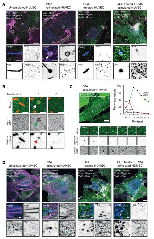 ECs use Myo1c as part of the WPB exocytic machinery. (A) Super-resolution imaging and immunofluorescent localization of endogenous Myo1c (green), actin (magenta), and VWF (blue) in unstimulated or PMA (100 ng/mL) stimulated HUVEC in the presence and absence of 1 μM of the actin polymerization inhibitor cytochalasin E (CCE). Scale bar, 10 μm. Inset, 1 μm. Myo1c is recruited independently of actin but was dependent on stimulation with PMA. (B) Myo1c-GFP encapsulates WPB after fusion as determined by live cell super-resolution spinning disk imaging of PMA stimulated (100 ng/mL) HUVEC coexpressing a Myo1c-GFP and the WPB fusion marker P.sel.lum.mCherry. Scale bar, 1 μm. Arrows indicate point of collapse/fusion of vesicle (C) Live cell imaging of LifeAct-GFP and P.sel.lum.mCherry expressing HDMEC indicated the utility of actin rings to expel VWF after stimulation. Scale bar, 10 μm. Inset, 1 μm. Z stacks of 0.5 μm were acquired continuously for 10 minutes (Zeiss LSM 800). (D) Confocal imaging and IF analyses of endogenous Myo1c in HDMEC that were left untreated or stimulated with PMA, CCE, or CCE and PMA. Arrows illustrate where Myo1c is recruited to fused/collapsed WPB. Scale bar, 10 μm.