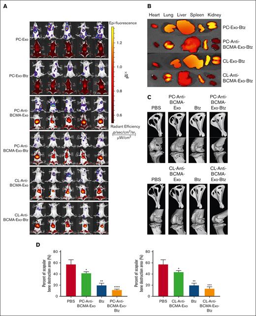 The distribution of DiR-labeled exosomes in vivo and its effect on bone lesion repair. (A) Biodistribution of DiR-labeled exosomes in LP-1 tumor bearing NSG mice. (B) Biodistribution of DiR-labeled exosomes in the heart, kidney, lung, liver and spleen of the mice. (C) Micro-CT image shown the bone destruction of the scapular. (D) The percentage of scapular bone destruction area in different treatment groups. ∗P < .05; ∗∗P < .01; ∗∗∗P < .001; ∗∗∗∗P < .0001.