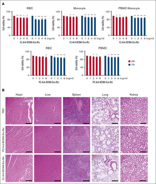 Safety assessment of anti-BCMA-Exo-Btz. (A) Red blood cells (RBCs), PBMCs, monocytes, and PBMCs except monocytes (PBMC-monocyte) were exposed to varying concentrations of 1, 2, 4, and 8 mg/mL anti-BCMA-Exo loaded with Btz for 48 and 72 hours, and the cell viability were detected. (B) H&E staining of the tissue of heart, kidney, lung, liver, and spleen. Scale bar, 200 μm. H&E, hematoxylin and eosin.
