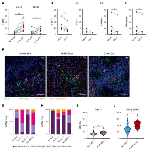 Effector CD70+ T cells are increased in blood and skin of patients with GVHD. (A) Percentage of CD4+CD70+ (left) and CD8+CD70+ (right) cells in patients who underwent allo-HSCT, with ongoing GVHD (n = 12) vs those without aGVHD (no GVHD; n = 12) at matched time points after HSCT. (B) Percentage of IFN-γ+ cells within CD4+CD70+ and CD4+CD70– cells in blood of patients with ongoing aGVHD (n = 6). (C) Percentage of interleukin-17–positive (IL-17+) cells within CD4+CD70+ and CD4+CD70– cells in blood of patients with ongoing aGVHD (n = 6). (D) Percentage of perforin-positive cells within CD4+CD70+ and CD4+CD70– cells in blood of patients with ongoing aGVHD (n = 6). (E) Percentage of granzyme-B–positive cells within CD4+CD70+ and CD4+CD70– cells in blood of patients with ongoing aGVHD (n = 6). (F) Immunofluorescence staining on skin, gut, and liver FFPE sections from 4 patients with severe aGVHD after allo-HSCT. Staining was performed with nuclei stain DAPI (blue), CD70-Cy3 (red), and CD3-FITC (green). Images taken at 40× magnification. Arrows indicate presence of double-positive (CD3+CD70+) T cells. (G-H) Cell surface expression of chemokine receptors CCR4 and CCR6 on total CD4+ and CD4+CD70+ (G), and total CD8+ and CD8+CD70+ T cells (H) in blood (PB) and skin. (I) Serum levels of sCD27 measured at day 14 after SCT in patients who subsequently developed aGVHD (n = 22), compared with patients who never developed aGVHD (n = 11). (J) Serum sCD27 measured in patients at onset of GVHD (n = 25), compared with patients who never developed aGVHD (n = 15) at matched time points after HSCT. Statistical comparisons were made using Wilcoxon matched-pairs signed-rank test (A-E,G): ∗P < .05; ∗∗P < .01; ∗∗∗P < .005. FITC, Fluorescein isothiocyanate.