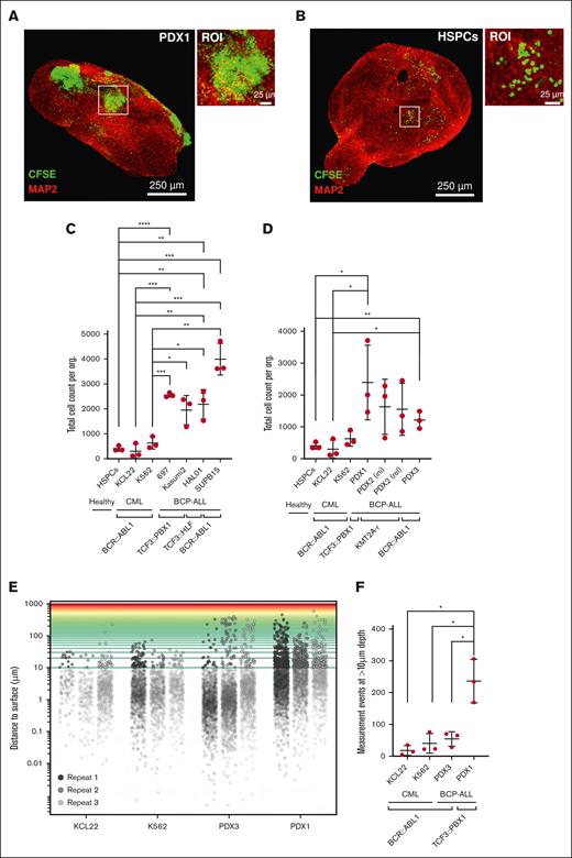 BCP-ALL cells robustly engraft into cerebral organoids as compared with healthy CD34+ HSPCs. (A-B) Cerebral organoids were cocultured with 10 000 CFSE-stained cells, either cord blood–isolated CD34+ HSPCs or leukemia cells, for 14 days. Enlarged images of cell clusters are shown by white squares (ROI). Scale bars: 25 μm and 250 μm. (C-D) Cerebral organoids were cocultured with 10 000 CFSE-stained leukemia cells or CD34+ HSPCs. After 14 days of coculture period, the total cell counts within the invaded organoids were quantitatively assessed by enumerating CFSE-positive cells in each organoid, using Imaris image processing software. Statistical analysis was conducted to compare the HSPCs, K562, and KCL22 controls to every other condition using the unpaired 2-tailed t test (n = 3 replicates). (E) Visualization of leukemia cell distribution within organoids using Matplotlib-based image analysis. 3D representation illustrates the relative distribution of leukemia cells within the organoid structure. Distances exceeding 10 μm are considered boundaries for deep invasion. (F) Depicted are number of cells that have invaded beyond 10-μm depth in the organoid 3D space (n = 3 replicates, unpaired 2-tailed t test).