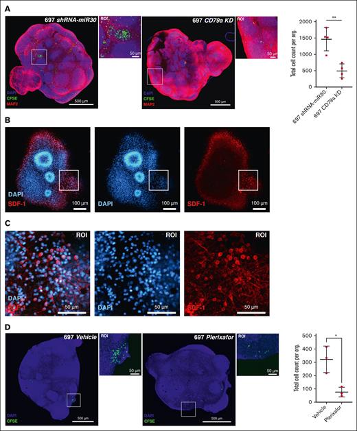 Inhibition of CD79a/Igα or CXCR4–SDF-1 interaction ablates TCF3::PBX1+ leukemia cells’ engraftment into cerebral organoids. (A) shRNA-miR30 (control) or shRNA-mediated CD79a knockdown (KD) 697 cells (10 000 cells) were seeded in a coculture assay with cerebral organoids for 14 days. Both conditions were analyzed using the unpaired 2-tailed t test, 697 CD79a vs 697 shRNA-miR30 (P = .0034). (B-C) To demonstrate the expression of stromal cell-derived factor in our cerebral organoids, we stained cerebral organoids with anti-SDF-1 antibody. A single z-slice of a complete 3D stack is shown above, including a portion of the image in the ROI. Immunofluorescence staining revealed colocalization with anti-MAP2 signal in cerebral organoids and the expression of SDF-1 significantly increased in neurons. (D) 697 wild-type (10 000) cells pretreated for 12 hours with (44 nM) plerixafor or with vehicle control in a coculture assay with cerebral organoids for 14 days. Both conditions were analyzed using the unpaired 2-tailed, vehicle treated vs plerixafor treated 697 cells (P = .0155). Scale bars: 50 μm, 100 μm, and 500 μm.