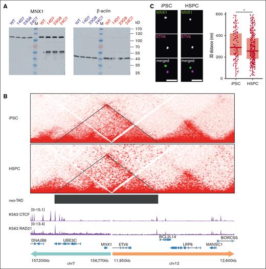MNX1 protein expression and chromatin interaction of the MNX1 gene with the ETV6 region in ChiPSC22t(7;12) cells. (A) Western blot with an MNX1 antibody (left) and iPSC (blue) and HSPC (red) protein extracts from ChiPSC22WT and ChiPSC22t(7;12) sublines 14D7, 23G8, and 24C7. The MNX1 protein (asterisk) is only detected in HSPCs of ChiPSC22t(7;12) sublines 14D7, 23G8, and 24C7. The common band at ∼120 kD results from an unknown protein cross-reacting with the MNX1 antibody. To demonstrate loading of equal protein amounts, the unstripped blot was reincubated with an antibody against β-actin (right). (B) Chromatin interactions analyzed by Hi-C seq in the genomic region flanking the translocation break point in the ChiPSC22t(7;12) subline 24C7, either as iPSCs (top) or HSPCs (below). The neo-TAD is indicated by a black bar. ChIPseq data for CTCF and RAD21 in K562 were retrieved from the encode project (IDs ENCFF468HJA and ENCFF000YXZ). (C) Increased proximity between MNX1 and ETV6 in ChiPSC22t(7;12) subline 14D7–derived HSPCs compared with iPSCs. Representative STED images of FISH spots in 2 colors targeting MNX1 and ETV6 in iPSCs and HSPCs (left). Scale bars, 500 nm. 3D distances between the MNX1 and ETV6 signals (right). Red horizontal lines within boxes indicate medians; box limits indicate upper and lower quartiles. iPSCs, n = 154; HSPCs, n = 409, across 3 independent replicates. ∗P < .05, Wilcoxon rank-sum test.
