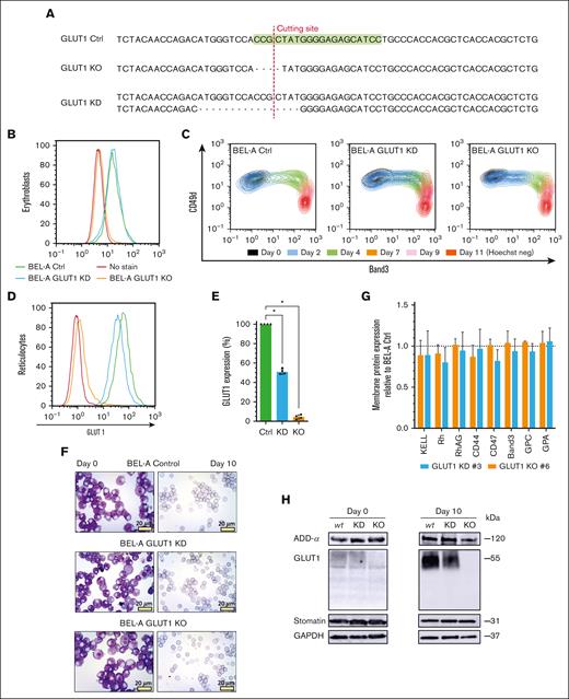 CRISPR–mediated GLUT1 KO on immortalized BEL-A erythroblasts successfully generate reticulocytes. (A) Sequencing of SLC2A1 (GLUT1) gene on Ctrl BEL-A, highlighting the guide RNA (green) used for CRISPR editing. Sanger sequencing of clonal edited lines shows a homozygous 4–base pair (bp) frameshift mutation on the GLUT1 KO line, and a heterozygotic 16-bp deletion on the KD line, both in the vicinity of the cutting site (red line). Flow cytometry histogram of GLUT1 staining in BEL-A erythroblasts (B) and derived reticulocytes (D) from Ctrl (green), GLUT1 KD (blue), and GLUT1 KO (orange) cell lines compared with no-stain control (red). Cells were stained with anti-GLUT1 eGFP conjugate. (C) Flow cytometry analysis of cell surface marker expression during differentiation. Cells were colabeled with anti-band3 primary antibody used in conjunction with an immunoglobulin G1 (IgG1) APC secondary and anti–α4-integrin FITC conjugate. For day 11, reticulocytes were identified using Hoechst as a nuclear DNA stain. (E) Bar graph illustrates the percentage GLUT1 expression on reticulocytes derived from indicated cell lines. Data are normalized to endogenous expression of Ctrl BEL-A from the median fluorescence intensity (n = 4). Individual data points are shown. Error bars indicate standard error of mean. (F) Representative images of May-Grünwald and Giemsa–stained cytospins depicting expanding BEL-A erythroblasts (day 0) and corresponding filtered reticulocytes after 10 day differentiation protocol; 40× original magnification. Scale bars, 20 μm, shown for each image. (G) Bar graphs illustrate expression of various membrane proteins on reticulocytes derived from indicated cell lines (n = 3). Reticulocytes were identified based on Hoechst stain negativity. Data are normalized to endogenous expression of Ctrl BEL-A and represents the median fluorescence intensity (n = 3). Individual data points are shown. Error bars indicate standard error of mean. (H) Western blots of lysates obtained from indicated cell lines at day 0 of differentiation and reticulocytes filtered after 10-day protocol, incubated with antibodies to α-adducin, GLUT1, stomatin, and glyceraldehyde-3-phosphate dehydrogenase (GAPDH; loading control). Multiple Mann-Whitney U tests were used to test for differences between groups. ∗P < .05. Error bars indicate standard deviation.