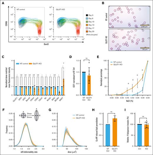 Properties of CD34+ GLUT1-KO–derived reticulocytes. (A) Waterfall plot indicating progression of control and GLUT1-KO–transfected cultures of single donor CD34+ differentiation. Cells were colabeled with anti-band3 primary antibody used in conjunction with an IgG1 APC secondary and anti–α4-integrin FITC conjugate. For day 20, reticulocytes were identified using Hoechst stain as a nuclear DNA stain. (B) Representative cytospins of the same culture were obtained on day 20 after leukofiltration. 40× original magnification. Scale bars, 20 μm, shown for each image. (C) Bar graphs indicate the expression of various membrane proteins on reticulocytes derived from NT or GLUT1-KO primary cultures (n = 6, for SMVT n = 3, with 2 technical repeats each). Significance was assessed by multiple Mann-Whitney U tests with a false discovery rate of 1% to account for multiple comparisons. “∗” shows q < .01 and “nd” shows q > .01. (D) Anti-transferrin receptor (CD71) labeling of on reticulocytes (n = 6, open or filled dots indicate 2 separate cultures, each with 3 donors). For both, reticulocytes were leukofiltered on day 20. Data are normalized to each donor-matched NT control and represents the median fluorescence intensity. (E) Osmotic resistance analysis calculated based on viable cell counts (flow cytometer) after incubation with decreasing concentrations of NaCl (n = 3, 2 technical replicates, “∘” P ≤ .0021). (F) Deformability and (G) cell area (μm2) were measured under shear stress by automated rheoscope cell analyzer (n = 3, N > 2000 cells), which elongates cells and measures length over width as deformability parameter. Shaded region represents the standard deviation. (H) Quantitative analysis of lipid peroxidation detected by a shift in the fluorescence signal after treatment with 25 mM cumene hydroperoxide. Data normalized to each donor-matched NT control (n = 3, 3 technical replicates). (I) Bar graph quantifying P falciparum reticulocyte invasion efficiency. Invasion was assessed by flow cytometry using a SYBR-green DNA stain (3 separate parasitemia percentages, 3 technical replicates) and data were normalized per matched-donor (n = 3) NT control. This figure comprises data obtained from 2 independent cultures, each of 3 donors with panels A-B presenting representative data from cultures with fluorescence-activated cell sorted GLUT1-KO purity of 99%; panels E-I 94% and panels C-D combined data from all 6 donors. A nonparametric Mann-Whitney U test or Kruskal-Wallis test with Bonferroni correction were used to test for differences between groups when not specifically mentioned, ∗P < .05, ∗∗P < .01, and ∗∗∗P < .001. Error bars indicate standard deviation.