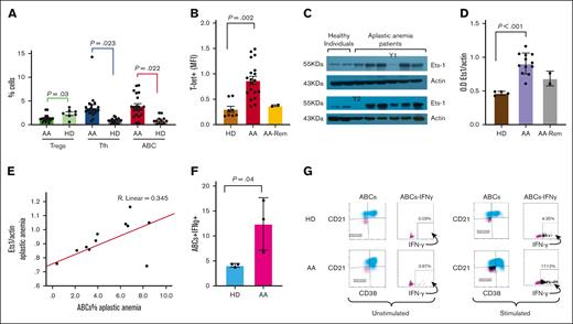 Increased age-associated B cells in acquired AA. (A) PBMC from patients and healthy individuals were stained with anti-CD38, anti-CD11c, anti-CD19, and anti-CD21 monoclonal antibodies followed by intracellular anti–T-bet monoclonal antibody for the ABCs, with anti-CD4, anti-CXCR5, anti-ICOS, and anti-PD1 monoclonal antibodies for the cTfh and with anti-CD4, anti-CD25, anti-CD127 monoclonal antibodies for the Tregs. Patients with AA (n = 21) displayed an increased frequency of ABCs and increased cTfh compared with HDs (n = 20). Patients with AA showed a lower percentage of CD4+CD25hiCD127lo T cells than healthy donors. The relative numbers from all study subjects are shown. The 2 patients in remission showed a comparable percentage of ABC to that observed in healthy individuals. All samples from patients and healthy donors were run in parallel during the same experiments. (B) Patients with AA showed increased T-bet expression in the ABC population compared with the T-bet expression in healthy individuals. The mean fluorescence intensity of T-bet expression is shown. The 2 patients in remission showed comparable levels of T-bet expression in ABC to those observed in healthy individuals. (y-axis; MFI T-bet in the ABC population). (C) Ets-1 protein levels were examined in protein extracts from the PBMC of patients and healthy controls. Western blot analysis revealed that patients with AA (n = 12) had increased Ets-1 protein levels compared with controls (n = 4). Two patients in remission (Y1 and Y2) showed comparable Ets-1 protein levels to those of healthy individuals. Increased Ets-1 protein levels are associated with increased T-bet expression in ABC in patients with AA. (D) Densitometry analysis of the western blots (Ets1/actin) showed statistically significant increased levels of Ets-1 protein in patients with AA compared with those of controls. The 2 patients in remission had comparable Ets-1 protein levels to those of healthy individuals. (E) The increased percentage of ABC (x-axis: % of ABC) in patients with AA correlates with increased Ets-1 protein levels (y-axis: Ets-1/actin protein levels) (R2 = 0.345). (F-G) PBMCs from patients with AA at diagnosis before any treatment (n = 3) and healthy individuals (n = 3) were left overnight in media or stimulated with phorbol myristate acetate and ionomycin. The cells were collected and analyzed using flow cytometry for the intracellular expression of IFN-γ. A representative experiment is shown from 1 patient and 1 healthy subject. The cells were stained with anti-CD38, anti-CD11c, anti-CD19, and anti-CD21 monoclonal antibodies, followed by intracellular staining for IFN-γ. The gating of IFN-γ expression in the ABC population is shown. Patients with AA showed increased intracellular levels of IFN-γ in the ABC compared with those in healthy controls. Stimulated cells showed a statistically significant increased IFN-γ levels compared with healthy subjects. Data from all patients and controls analyzed are shown in Panel F. AA, aplastic anemia; AA Rem, patients with AA in remission; ABC, age-associated B cells; ABCs+IFN-γ, percentage of intracellular IFN-γ levels in age-associated B cells; cTfh, circulating T follicular helper cells; HD, healthy donor; OD Ets1/Actin, densitometry analysis of Ets1 protein levels to actin levels; Tregs, regulatory T cells.