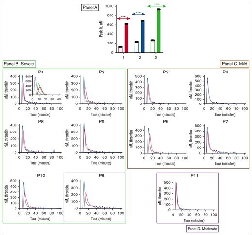 Effect of PS antibody on plasma thrombin generation. (A) Effect of PS antibody on plasma thrombin generation in 3 FIX-deficient commercial plasmas (George King, Stago, and HTI plasmas) represented as red (1), blue (2), and green (3) bars, respectively. The plasmas were incubated with 90 nM of FIX without (empty bar in each category) and with (filled bar in each category) a 450-nM PS antibody. Thrombin generation was measured in the presence of corn trypsin inhibitor (1 μM) and reagent B containing 0.4-pM tissue factor. The thrombin generation was initiated with a mixture of CaCl2 and the fluorogenic substrate Z-Gly-Gly-Arg-AMC. The bars represent the peak thrombin that formed. Although many patients had recently received prophylactic FIX infusions, peak thrombin still increased in the presence of PS antibody. Student uncoupled t test was performed (P < .0001) to determine the level of significance as described.34 (B-D) Effect of PS antibody on thrombin generation in patient plasmas (patients 1-11). Results are grouped according to severity of hemophilia, with panels B-D representing severe, mild, and moderate hemophilia, respectively. Patient 6, the single severe patient managed with an SHL product, is denoted by highlighting with a purple box. Patient plasmas were incubated with (blue curve) and without (red curve) PS antibody. Panel B P1 inset plot: effect of control (red - no TFPI antibody or PS antibody), TFPI antibody (green), and TFPI antibody + PS antibody (purple) on plasma thrombin generation.