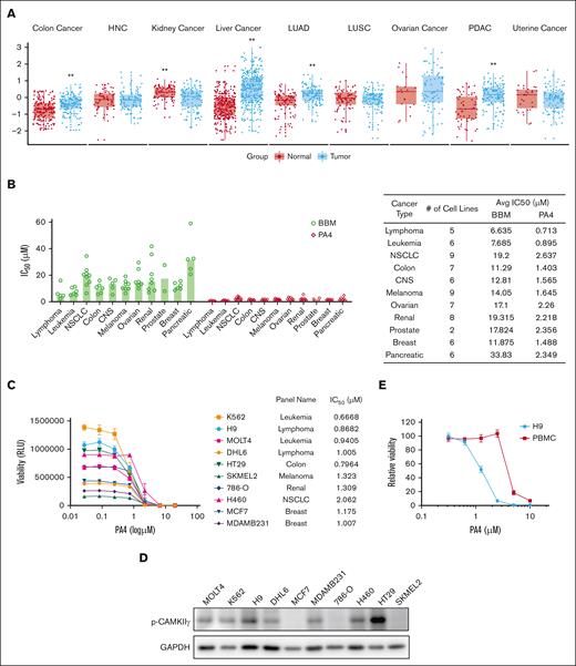 PA4 preferentially targets hematological cancers. (A) Box plots of CAMKIIγ T287 phosphorylation/total protein level among 9 types of cancers from the cProSite database; ∗∗P < .01. (B) Summary of IC50 of BBM or PA4 in cancer-derived cell lines treated with BBM or PA4 for 72 hours. Data are shown as individual values with median. (C) Summary of IC50 of BBM or PA4 in 10 selected cell lines treated with PA4 for 72 hours. (D) Relative viability of H9 and human peripheral blood mononuclear cells (PBMCs) incubated with indicated dosages of PA4 for 24 hours. (E) CAMKIIγ T287 phosphorylation level among 10 selected cell lines from panel C was measured by western blot. Glyceraldehyde-3-phosphate dehydrogenase (GAPDH) was used as loading control. Avg, average; CNS, central nervous system; HNC, head and neck cancer; LUAD, lung adenocarcinoma; LUSC, lung squamous cell carcinoma; NSCLC, non–small cell lung cancer; PDAC, pancreatic adenocarcinoma; RLU, relative light unit.