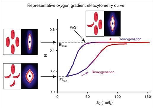 Representative oxygen gradient ektacytometry curve. RBC deformability is continuously measured with the laser assisted optical rotational red cell analyzer (Lorrca) while the sample is gradually deoxygenated and reoxygenated. Oxygen gradient ektacytometry generates 3 key parameters: EImax reflects deformability at normoxia; EImin represents minimal deformability due to change in shape; and orientation of RBCs when sickling, upon deoxygenation. PoS embodies the oxygen tension when the first RBCs start to sickle. Diffraction patterns and schematic illustration of RBCs that cause the change in deformability (EI) are shown for each parameter. Parts of this figure have been created with BioRender.com.