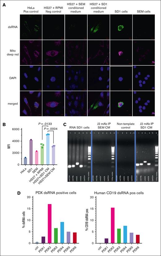 CAF-inducing B-ALL cells contain mtdsRNA, which is released and taken up by MSCs. (A) Photomicrographs of confocal images of cells stained with anti-dsRNA monoclonal antibody J2, Deep Red MitoTracker, and DAPI, as well as merged images, as indicated on the left. Cell types and experimental conditions are indicated above the image. (B) MFI (Y axis) after intracellular J2 staining and flow cytometry of the cells indicated on the X axis. HS27a + SD-1 or SEM indicates HS27a cells exposed to the SD-1 or SEM conditioned medium. (C) Agarose gel images showing the products of reverse transcription-PCR for 4 mitochondrial genes, and GAPDH with a 100 base pair ladder (as indicated below the bands) from the experimental conditions indicated at the top of the individual gel images: positive control (SD-1 cells), J2-immunoprecipitated RNA from SD-1 and SEM cells, and negative nontemplate control. (D) Bar chart showing percentage of ALL patient–derived xenograft (PDX) cells (Y axis) positive for dsRNA after intracellular J2 staining and flow cytometry. PDX 1, 4, and 6 are derived from BCR::ABL1+ ALL, and PDX 2, 3, and 5 from KMT2A::AFF4+ ALL. CM, conditioned medium; MFI, mean fluorescence intensity.