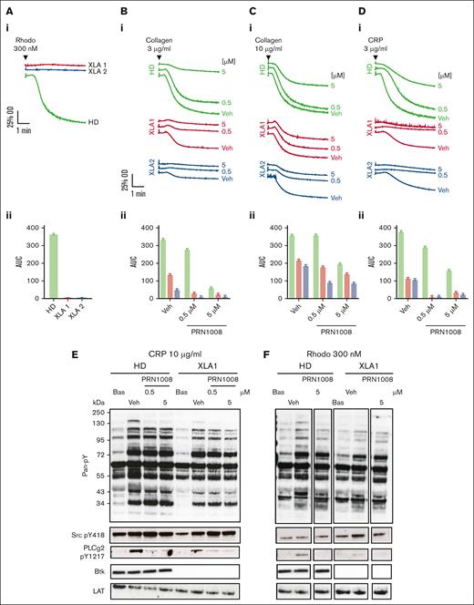 PRN1008 blocks GPVI-mediated aggregation and PLCɣ2 phosphorylation in XLA platelets at low agonist concentrations of agonist. (A-D) Healthy donor and XLA washed platelets (2 × 108/mL) were incubated with vehicle (0.02% DMSO) or indicated concentration (0.5 and 5 μM) of PRN1008 for 1 hour before platelet aggregation to snake venom toxin rhodocytin 300 nM (A), collagen 3 (B) and 10 μg/mL (C), and CRP (3 μg/mL) (D) was measured by lumi-aggregometry. Representative traces (i) and quantification (ii); n = 3 for healthy donor; n = 2 for XLA. (E-F) Healthy donor and XLA washed platelets (4 × 108/mL) were incubated with vehicle (0.02% DMSO) or indicated concentration (0.5 or 5 μM) of PRN1008 for 1 hour, then stimulated with snake venom toxin rhodocytin 300 nM (E) or CRP 10 μg/mL (F) for 180 seconds in the presence of eptifibatide (9 μM) and lysed with reducing sample buffer. Whole cell lysates were then separated by SDS-PAGE and western blotted for tyrosine phosphorylation of indicated proteins. Total LAT was used as a loading control. Representative western blots (n = 1). OD, optical density; Veh, vehicle.