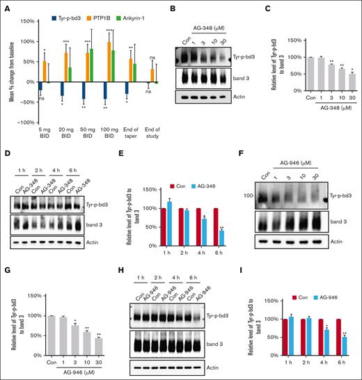 Effect of PK activators on Tyr-p-bd3. (A) In vivo effect of AG-348 on Tyr-p-bd3, PTP1B, and ankyrin-1. The levels of Tyr-p-bd3, intact PTP1B, and membrane-associated ankyrin-1 were quantified by western blotting in frozen blood samples from 15 patients (Tyr-p-bd3 and PTP1B) or 11 patients (ankyrin-1) treated twice daily with 5-, 20-, 50-, and 100-mg AG-348. ∗P ˂ .05; ∗∗P ˂ .01; ∗∗∗P ˂ .001. (B-E) Ex vivo effect of AG-348 on Tyr-p-bd3. HbSS RBCs were treated with DMSO (Con) or different concentrations (1, 3, 10, and 30 μM) of AG-348 in DMSO for 4 hours (B-C) or 30-μM AG-348 for different times (1, 2, 4, and 6 hours) (D-E). The level of Tyr-p-bd3 was analyzed by western blotting and quantified by densitometry analysis. The mean reduction on Tyr-p-bd3 of RBC treated with 1-, 3-, 10-, and 30-μM AG-348 were 1%, 22%, 35%, and 50%, respectively, and with 30-μM AG-348 for 2, 4, and 6 hours were 6%, 28%, and 59%, respectively. ∗P ˂ .05; ∗∗P ˂ .01. (F-I) Ex vivo effect of AG-946 on Tyr-p-bd3. HbSS RBCs were treated with DMSO (Con) or different concentrations (1, 3, 10, and 30 μM) of AG-946 in DMSO for 4 hours (F-G) or 30-μM AG-946 for different times (1, 2, 4, and 6 hours) and the level of Tyr-p-bd3 analyzed by western blotting and quantified by densitometry analysis (H-I). The mean reduction on Tyr-p-bd3 of RBC treated with 1-, 3-, 10-, and 30-μM AG-946 were 3%, 24%, 41%, and 56%, respectively, and with 30-μM AG-946 for 4 and 6 hours were 29% and 49%, respectively. ∗P ˂ .05; ∗∗ P ˂ .01. Three biological replicates (blood samples from 3 different HbSS donors) were used in all ex vivo assays, except in panels H and I, which had 4 biological replicates. ∗P ˂ .05; ∗∗P ˂ .01.