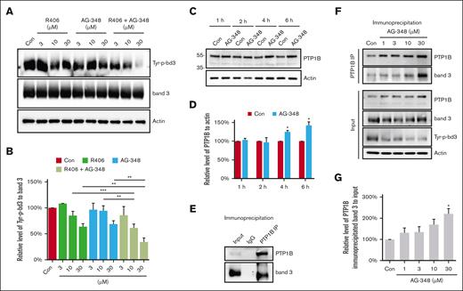 Effect of AG-348 on protein phosphatase, PTP1B. (A-B) Ex vivo effect of AG-348 and R406 on Tyr-p-bd3. HbSS RBCs were treated with DMSO (Con) or different concentrations (3, 10, and 30 μM) of R406, AG-348, or a combination of R406 and AG-348 for 6 hours, and the level of Tyr-p-bd3 was analyzed by western blotting and quantified by densitometry analysis. The mean reductions on Tyr-p-bd3 of RBCs treated with 10- and 30-μM R406, AG-348, or a combination compared with vehicle control were 15% and 36%, 6% and 31%, 39% and 66%, respectively. ∗∗P ˂ .01; ∗∗∗P ˂ .001. (C-D) Effect of AG-348 on RBC PTP1B. HbSS RBCs were treated with DMSO (Con) or 30-μM AG-348 in DMSO for different times (1, 2, 4, and 6 hours), and the level of membrane-associated intact PTP1B was analyzed by western blotting and quantified by densitometry analysis. The mean increase on PTP1B of RBCs treated with 30-μM AG-348 for 4 and 6 hours were 25% and 43%, respectively. ∗P ˂ .05. (E) Immunoprecipitation with anti-PTP1B antibody clearly showed interaction between PTP1B and band 3. (F-G) HbSS RBCs were treated with DMSO (Con) or different concentrations (1, 3, 10, and 30 μM) of AG-348 for 8 hours, and the interaction between PTP1B and band 3 was measured by immunoprecipitation and quantified by densitometry analysis. The mean increase on the interaction between PTP1B and band 3 of RBC treated with 1-, 3-, 10-, and 30-μM AG-348 were 31%, 35%, 70%, and 121%, respectively. ∗P ˂ .05. Three biological replicates of HbSS donors were used in all ex vivo assays. IgG, immunoglobulin G.