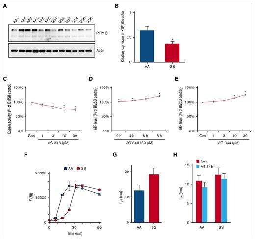 Effect of AG-348 on calpain activity, ATP production, and Ca2+ efflux. (A-B) PTP1B in HbAA vs HbSS RBCs. The levels of membrane-associated intact PTP1B in RBCs from 6 pairs of healthy controls (AA1-6) and HbSS patients (SS1-6) were analyzed by western blotting and quantified by densitometry. The relative levels of PTP1B to actin in AA1-6 RBCs were 0.42, 0.84, 0.81, 0.63, 0.39, and 0.75, respectively, with an average of 0.64; and in SS1-6 RBCs were 0.28, 0.63, 0.37, 0.21, 0.51, and 0.20, respectively, with an average of 0.37. ∗P ˂ .05. (C) Effect of AG-348 on calpain activity. HbSS RBCs were treated with DMSO (Con) or different concentrations (1, 3, 10, and 30 μM) of AG-348 in DMSO overnight, and the activity of calpain was measured using Calpain Activity Assay Kit. Mean reductions in calpain activity of RBCs treated with 1-, 3-, 10-, and 30-μM AG-348 were 9%, 15%, 24%, and 26%, respectively. ∗P ˂ .05. (D-E) Effect of AG-348 on ATP production. HbSS RBCs were treated with DMSO (Con) or 30-μM AG-348 in DMSO for different times (2, 4, 6, and 8 hours) or different concentrations (1, 3, 10, and 30 μM) of AG-348 in DMSO for 8 hours; ATP level was analyzed using CellTiter-Glo 2.0 Cell Viability Assay kit. The mean increase in ATP levels of RBCs treated with 30-μM AG-348 for 2, 4, 6, and 8 hours were 2%, 5%, 11%, and 21%, respectively, and with 1-, 3-, 10-, and 30-μM AG-348 for 8 hours were 2%, 5%, 14%, and 26%, respectively. Three biological replicates of HbSS donors were used in the study here. ∗P ˂ .05. (F-H) Effect of AG-348 on Ca2+ efflux. (F) Ca2+ efflux kinetics were measured using extracellular Fluo-8. Symbols represent mean ± standard error of the mean (SEM) from triplicate measurements from single HbAA and HbSS donors (dark blue and red circles, respectively). Notice the slower efflux with the SS donor. (G) Mean ± SEM efflux halftimes from 4 donors, measured similar to panel F. The slower efflux observed from SS erythrocytes did not reach statistical significance. (H) Mean ± SEM efflux halftimes for indicated cells after a 6-hour treatment with 30-μM AG-348 or matched DMSO control (blue and red bars, respectively, for each genotype). RBCs from 4 pairs of ethnic-matched healthy controls (HbAA) and HbSS patients were used in each assay, and the results represent a mean from the 4 separate assays.