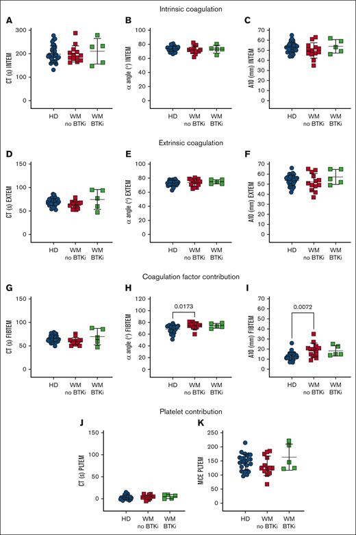 WM coagulation factors contribute robustly in a WB clotting assay. ROTEM measurements in WB samples from HDs (n = 31, blue), patients with WM not on therapy (n = 13, red) or receiving BTKis (n = 5, green). (A-C) INTEM is triggered by calcium, phospholipids, and ellagic acid. (D-F) EXTEM is triggered by calcium and tissue factor, whereas (G-I) FIBTEM additionally inhibits platelet cytoskeletal changes with cytochalasin D and reflects the coagulation factor contribution to thrombus formation. (J-K) EXTEM-FIBTEM (PLTEM) reflects the platelet contribution to thrombus formation. Mean ± SD. P values were determined by Kruskal-Wallis 1-way ANOVA with Dunn's multiple comparisons test. MCE, maximum clot elasticity (MCF × 100)/(100 − MCF); MCF, maximal clot firmness.