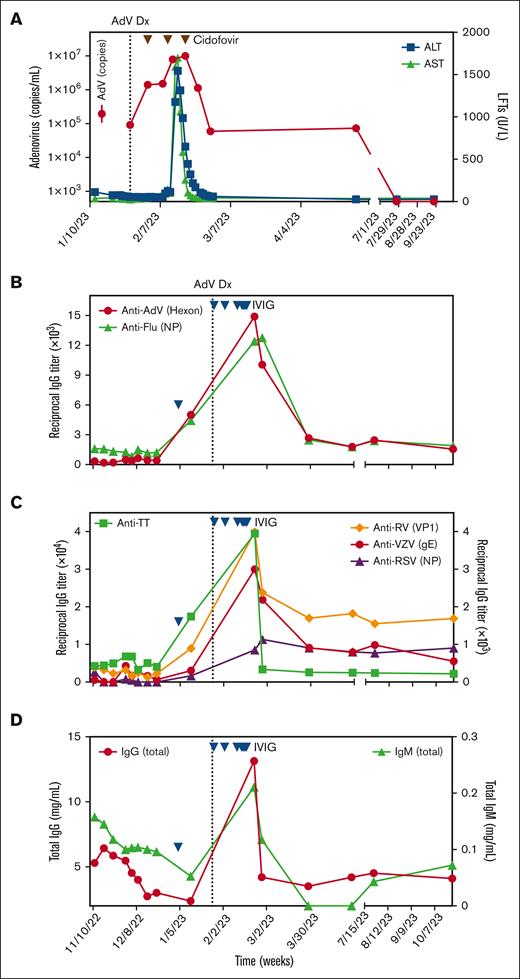 Course of Adv infection and antiviral humoral immunity in a patient with myeloma after CAR T-cell therapy. (A) Time course of adenoviral copy numbers (red), ALT (alanine transaminase; blue), and AST (aspartate aminotransferase; green) serum levels. Black triangles indicate the administration of cidofovir. The black dotted line indicates the time point at which the diagnosis of Adv infection was made. (B) Time course of the anti-AdV (red) and anti-influenza A (green) titers. IgG antibody titers against full-length recombinant AdV hexon protein (Abcam, catalog no. ab123995) and influenza nucleoprotein (NP; Sino Biologicals, catalog no. 11675-V08B) were measured using enzyme-linked immunosorbent assay (ELISA). Recombinant glutathione S-transferase (GST) protein (Sino Biologicals, catalog no. 15237-H08H) was used as a control. Blue triangles indicate the administration of IV immunoglobulin. The black dotted line indicates the time point at which the diagnosis of Adv infection was made. (C) Time course of the different antimicrobial antibody titers. IgG antibody titers against full-length tetanus toxoid (green; Sigma-Aldrich, catalog no. 582231), recombinant rhinovirus (RV) capsid protein (VP1; orange; MyBioSource, catalog no. MBS1220686), varicella-zoster virus (VZV) envelope glycoprotein E (gE; red; ACROBiosystems, catalog no. GLE-V52H3), and respiratory syncytial virus (RSV) NP (purple; Sino Biologicals, catalog no. 40821-V08E) were measured by ELISA. GST protein was used as a control. Blue triangles indicate the administration of IV immunoglobulin. The black dotted line indicates the time point at which the diagnosis of Adv infection was made. (D) Time course of serum levels of total IgG (red; catalog no. BMS2091TEN) and IgM (green; catalog no. BMS2098TEN) were determined using commercially available ELISA kits from Thermo Fisher. Plasma was generated by centrifugation at 400g and frozen immediately at –80ºC. Peripheral blood mononuclear cells (PBMCs) were isolated using density gradient centrifugation and frozen in liquid nitrogen. Dx, diagnosis; LFT, liver function tests.