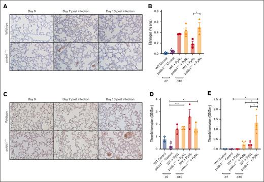Platelet-specific Ido1−/− mice had increased thrombi in their lungs after infection compared with WT infected mice. (A) Fibrinogen was stained and quantified on day 7 and 10 lung sections to detect thrombi. Images were taken at ×40 original magnification, scale bar represents 50 μm, and (B) immunohistochemistry quantification with ImageJ. (C) Lung sections were immunostained for CD42c on day 7 and 10 after infection to detect thrombi. Images were taken at ×40 original magnification, scale bar represents 25 μm. (D-E) Quantification of (D) thrombi <10 μm or (E) >10 μm averaged over 5 fields per mouse. Data presented as mean ± SEM (∗P < .05, ∗∗P < .01, ∗∗∗P < .001). Data were analyzed using unpaired 2-tailed Student t test.