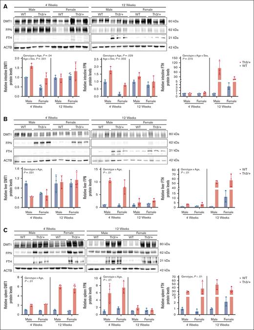 Variations in the expression of iron transporters correlates with perturbations in iron flux in Th3/+ mice. Expression of DMT1, FPN, and FTH was quantified in duodenal epithelial tissues (A) and in the liver (B) and spleen (C) of 4- and 12-week-old male and female WT (blue bars) and Th3/+ (red bars) mice. Data are presented as mean ± SD for n = 3 mice per group and were analyzed by 3-way ANOVA. P values in each panel indicate the significance of genotype, age, and sex interactions and main effects.