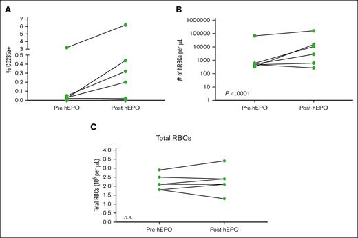 Human EPO increases hRBC levels in peripheral blood of HMOX-1–/– HIS mice. HMOX-1–/– MSRG47 mice were intrahepatically engrafted with hHSCs. At 12 weeks after engraftment, mice were bled retro-orbitally to examine the level of hRBCs in peripheral blood before being injected intraperitoneally with 100 units of hEPO. At 1 week after injection, hRBCs were reassessed from the retro-orbital bleed. (A) Percentage of hRBCs in peripheral blood of HMOX-1–/– MSRG47 mice before and after hEPO treatment. (B) Total number of hRBCs per microliter of peripheral blood before and after hEPO treatment. (C) Total number of RBCs per microliter of peripheral blood before and after hEPO treatment. Two independent experiments were performed. Data represent the mean ± SEM with individual mice shown. Statistical analysis was evaluated by paired Student t test.