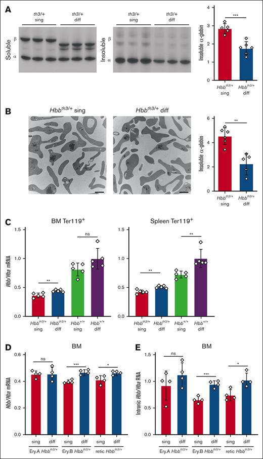 Reduced free α-globin in Hbbth3/+ mice with the Hbb diffuse haplotype. (A) Soluble and insoluble globins in RBCs determined by biochemical fractionation and triton acid urea (TAU) gel electrophoresis. Representative TAU gel images are shown in the left panels and the results of multiple experiments are summarized in the graph on the right. The y-axis represents relative staining intensities of insoluble α-globin on TAU gels, measured by automated image analysis and expressed in arbitrary units. Hbbth3/+ sing, n = 5; Hbbth3/+ diff, n = 6. (B) Transmission electron microscopy of flow cytometry–purified reticulocytes showing electron-dense, α-globin inclusions. Representative micrographs are shown in the 2 left panels. The scale bars represent 2 μm. The graph on the right shows the results of quantitative automated image analysis of multiple mice with relative levels of α-globin inclusions indicated on the y-axis using an arbitrary scale. Hbbth3/+ sing, n = 6; Hbbth3/+ diff, n = 5. (C) Hbb/Hba mRNA ratios in Ter119+ erythroblasts from bone marrow (BM, left) or spleen (right) of mice with the indicated genotypes, determined by RNA-sequencing analysis. Five mice were assessed per genotype. (D) Hbb/Hba mRNA ratios in EryA and EryB erythroblasts isolated from BM and reticulocytes (retic) isolated from peripheral blood, determined by RNA-sequencing analysis. Four mice were assessed per genotype. (E) Intronic Hbb/Hba RNA ratios in the samples described for panel D. All graphs show data as mean value ± SD. ∗P < .05; ∗∗P < .01; ∗∗∗P < .001; ns, not significant; SD, standard deviation.