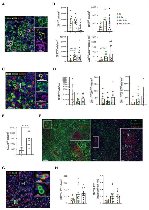 EBV and HIV/EBV infection are associated with similar innate immune cell composition of cHL TME. (A) Representative fluorescence images of CD11c (green), CD68 (yellow), and CD163 (magenta) in a HIV/EBV tissue (donor 22). Insets show CD11chigh (top), CD68high (middle), and CD163high (bottom) cells. Nuclei were visualized with DAPI. (B) Bar graphs showing the cell densities of CD11chigh, CD68high, CD163high, and CD68highCD163high in the 3 clinical pathological subgroups. (C) Representative fluorescence images of CD68 (yellow), CD163 (green), and CXCL13 (red) in a NI tissue (donor 4). Nuclei were visualized with DAPI. Insets show CD68high (top), CD163high (middle), and CXCL13high (bottom) cells. (D) Bar graphs showing the cell densities of CXCL13high, CXCL13high CD68high, and CXCL13high CD163high populations in the 3 clinical pathological subgroups. (E) Bar graph showing the cell densities of bulk CXCL13high cells in viremic compared with ART HIV/EBV cHL TME. Statistical analyses were performed using Mann-Whitney test; ∗P < .05. (F) Representative fluorescence images of CD30 (cyan), heparan sulfate (green), and CXCL13 (red) in NI (donor 6), EBV (donor 16), and HIV/EBV (donor 27; of 4 HIV/EBV tissues analyzed) tissues. (G) Representative fluorescence images of CD8 (red) and GrzB (green) in an EBV tissue (donor 16). Nuclei were visualized with DAPI. Insets show CD8negGrzBhigh (top) and CD8negGrzBhigh (bottom) cells. (H) Bar graphs showing the cell densities of the CD8negGrzBhigh population in the 3 clinical pathological subgroups. Statistical analysis was performed using Mann-Whitney test for panels B,D,F, and P values were corrected using FDR correction with q of 0.05.