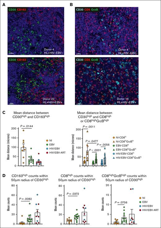Similar spatial distribution between HRS and effector CD8, macrophages in EBV and HIV/EBV cHL TME. (A) Representative fluorescence images of CD30 (green) and CD163 (red) in a NI (donor 4) and a HIV/EBV (donor 22) tissue. Nuclei are visualized with DAPI. (B) Representative fluorescence images of CD30 (green), CD8 (red), and GrzB (green) in a NI (donor 4) and a HIV/EBV donor (donor 16). Nuclei were visualized with DAPI. (C) Bar graphs showing mean distances (in microns) between CD30high and CD163high cells (left) and between CD30high and CD8high or GrzBhighCD8high T cells (right). (D) Bar graphs showing mean cell counts of CD163high, CD8high, and GrzBhighCD8high T cells in a 50-μm radius around CD30high cells. Statistical analysis was performed using Mann-Whitney test, and P values were corrected using FDR correction with q of 0.05, for multiple comparisons. P values without correction are shown for the comparisons between bulk CD8high and GrzBhigh CD8high T cells within each clinicopathological group (C, right panel).
