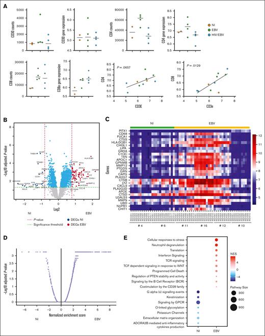 Transcriptome profiling reveals an augmented inflammatory TME in EBV compared with NI cHL TME. (A) Scatter dot plots showing the CD30high and CD4high T-cell counts (imaging analysis) and the corresponding CD30 and CD4 gene expression in the 3 clinical pathological subgroups (top row). Scatter dot plots showing the CD8 T-cell counts (imaging analysis), and CD8A gene expression in the 3 pathological subgroups (bottom row, left). Scatterplots showing the correlation between CD4 and CD3E as well as CD8A and CD3E gene expression. (B) Volcano plot showing differentially expressed genes between the 2 pathological subgroups. (C) Heat map showing the top DEGs (upregulated, in red) in the EBV compared with NI clinical pathological subgroup. Each column represents an individual analyzed Region of Interest for a given donor (the corresponding donor number is shown below) and each row corresponds to an individual gene analyzed. (D) Volcano plot showing global pathway analysis between the NI and EBV tissues. (E) Dot plot showing specific pathways with significantly different expression between the NI and EBV cHL pathological subgroups. The size of each circle corresponds to the number of genes analyzed in a given pathway (right). All presented data were generated with the GeoMx platform. NI (n = 2) and EBV (n = 4) cHL donors were analyzed. Simple linear regression for panel A and t test for panels C,E were used for the analysis. The significance for the GeoMx data comparisons was tested by nonpaired t test. DEGs, Differentially Expressed Genes; GPCR, G Protein-Coupled Receptor; TCF, T cell factor; WNT, Wingless and Int-1.