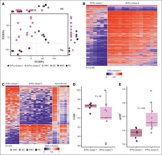 Identification of 2 B-PLL epitypes with signatures related to normal B-cell differentiation. (A) PCA analysis showing PC1 and PC2 with B-PLL and normal B-cell samples. On its side, the boxplots display differences between B-PLL epitypes and normal B cells. (B) Heat map of the differentially methylated CpGs (n = 5465) between B-PLL epitypes. (C) Heat map of the differentially methylated CpGs between B-PLL epitypes related to methylation patterns of NBCs and MBCs (n = 379, of which 249 are hypermethylated and 130 hypomethylated in epitype 1). (D) Percentage of IGHV gene identity B-PLL epitypes. (E) Magnitude of the epiCMIT scores between B-PLL epitypes.