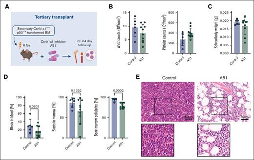 Csnk1a1–/+Trp53 mutant leukemias in tertiary transplants are sensitive to A51 treatment. (A) Schematic representation of tertiary sublethally irradiated (6 Gy) WT recipients of secondary Csnk–/+p53-transformed bone marrow cells (untreated controls, n = 6; A51-treated, n = 10). A51-treated mice received A51 compound (5 mg/kg per day) starting at 8 days after transplant, 5 days per week until 4 weeks after transplant (euthanasia). (B) White blood cell and platelet counts of control and A51-treated mice at 4 weeks after transplant (euthanasia). (C) Spleen-to-bodyweight ratio in control and A51-treated mice. (D) Percentage of blasts in peripheral blood and bone marrow, and bone marrow cellularity in control and A51-treated mice at 4 weeks after transplant (euthanasia). (E) HE staining of bone marrow (femur) sections (scale bar, 50 μm).