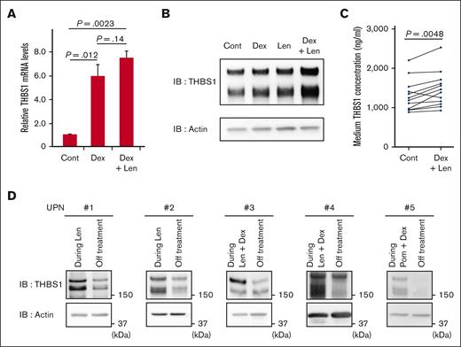 Lenalidomide and dexamethasone synergistically increase intracellular THBS-1 level. (A) Relative mRNA expression levels of THBS1 in THP1 cells. Cells were treated with DMSO, 1 μM dexamethasone with or without 10 μM lenalidomide for 24 hours. Data are from 3 independent experiments and expressed as means ± SEM. P values were determined by 2-tailed Student t test. (B) Immunoblot analysis for THBS-1 in THP1 cells treated for 24 hours with each drug. (C) THBS-1 concentration in the culture medium of PBMNCs. PBMNCs from healthy donor were cultured in RPMI-1640 for 24 hours with or without 1 μM dexamethasone and 10 μM lenalidomide, and THBS-1 concentration of medium was evaluated by ELISA assay. (D) Serial changes in THBS-1 protein level of PBMNCs from case 1 to 5 listed in supplemental Table 1. Cont, control; Dex, dexamethasone; IB, immunoblotting; Len, lenalidomide; Pom, pomalidomide; UPN, unique patient number.