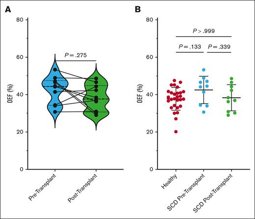 OEF changes from before to after transplant and compared with healthy controls. (A) OEF does not significantly change in adults with SCD before and after HSCT (P = .28). Individual participant changes are shown overlayed on the symbol and line graph, whereas group data are shown in violin plots, with the bolded dashed line showing the median and smaller dashed lines showing the upper and lower quartiles for participants before (blue plot) and after transplant (green plot). (B) Box-and-whisker plots of OEF shown in healthy adults (left; red dots) and in adults with SCD before transplant (middle; blue dots) and after transplant (right; green dots). OEF in patients with SCD is similar to values found in healthy adults both before (P = .13) and after transplant (P = .34).