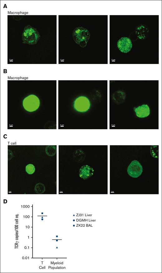 Confocal imaging of GFP localization and analysis of TCR rearrangement within tissue-resident cells excludes phagocytosis as major source of GFP in tissue macrophages. Confocal microscopic images of cellular GFP protein localization in sorted GFP+ tissue macrophages from the liver of animals that underwent transplantation and BAL (lung) samples demonstrate both (A) cellular organelle organization and (B) cytosolic GFP expression. (C) Confocal microscopic analysis of GFP expression patterns in T cells from the same samples are both localized to organelles and/or widespread throughout the cytoplasm. (D) Fraction of rearranged TCR DNA in purified T cells and macrophages from the liver and BAL of 2 animals that underwent transplantation (ZJ31 and ZK22) and 1 unmanipulated (DGMH) animal.