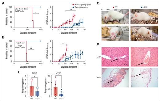 MIR155HGΔexon3 human T cells protects from acute GVHD in a xenogeneic model of disease. Xenogeneic GVHD transplants were performed as described in methods. NSG mice were injected with (A) 5 × 106 (n = 3 per cohort) and (B) 10 × 106 MIR155HGΔexon3 or NT human T cells (n = 5 per cohort). Survival curves (left) and acute GVHD clinical scores (right). Data combined from 2 independent donors, ∗P < .05, ∗∗P < .01, ∗∗∗P < .001. (C) Representative images of NT (left) and MIR155HGΔexon3 (right) recipient mice when the GVHD scores reached ≥4 and mice met euthanization criteria in the NT cohort. (D) Hematoxylin and eosin staining of liver (top) and skin (bottom) sections from mice receiving MIR155HGΔexon3 (right) or NT T cells (left). (E) Pathology scores for liver and skin from MIR155HGΔexon3 and NT-recipient mice at time of euthanasia (∗P < .05).