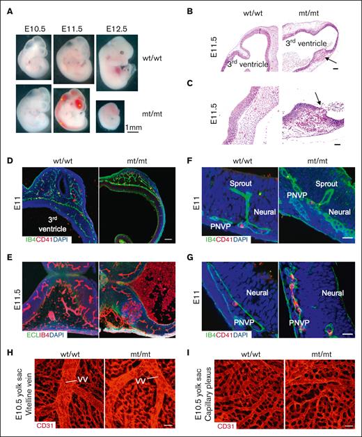 Homozygous P735R-knockin embryos develop distended vascular sprouts and spontaneous hemorrhages in the brain. (A) Comparison of wt/wt and mt/mt embryos at different developmental stages. Blood is visible in the hearts of the older embryos. Asterisks indicate hemorrhages in the brain ventricles, spinal cord, and spinal canal of E11.5 mt/mt embryos. The E11.5 and E12.5 mt/mt embryos are dead and appear pale as blood circulation has ceased. (B) Hematoxylin-eosin staining of coronal section of the wt/wt and mt/mt embryos’ heads at E11.5. Arrows indicate hemorrhagic lesions, which are shown at higher magnification in (C). Hemorrhages are visible in both the brain parenchyma as well as in the ventricles. Erythrocytes are nucleated at this stage of development. (D) Confocal images of angiogenic sprouting into the ventricle from PNVP of the diencephalon (coronal section) of E11 and (E) E11.5 embryos. (F) Confocal images of diencephalon distended sprouts and (G) accumulated eMKs in mt/mt embryos at E11. Neural, brain tissue. PNVP, perineural vascular plexus. ECL intensity reflects the degree of asialylation. In E11.5 mt/mt embryos, the hemorrhage penetrated the brain tissue and spread into the ventricle. IB4 marks the vasculature. CD41 marks eMKs and platelets (mostly eMKs at this stage). (H) Confocal microscopy images of wholemount stained E10.5 yolk sac with CD31 near the vitelline vein and (I) capillary plexus. Scale bar, 100 μm (B, D, F, H, I); 25 μm (C, E, G).