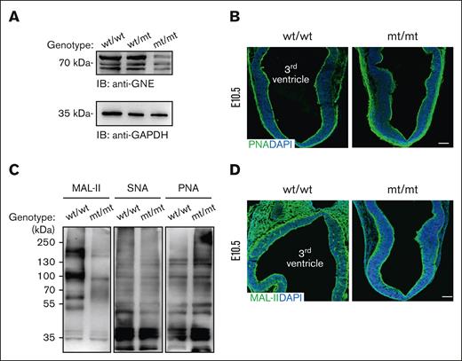 Homozygotic P735R mutation of Gne causes hyposialylation in mice. (A) Western blotting of GNE and GAPDH as loading control using mouse tissue extracts at E10.5. (B) Confocal images of PNA staining in wt/wt and mt/mt E10.5 embryos. (C) Lectin blotting of E10.5 tissue extracts probed with MAL-II, which detects α2,3-sialylated glycans, SNA, which detects α2,6-sialylated glycans, and PNA, which detects non-sialylated core 1 O-glycans (also known as T-antigen). The blots are representative of 4 independent experiments. (D) Confocal images of MAL-II staining in wt/wt and mt/mt E10.5 embryos. MAL-II, Maackia amurensis lectin II; PNA, peanut agglutinin. N = 3 for each genotype in (B) and (D). Scale bar, 100 μm.
