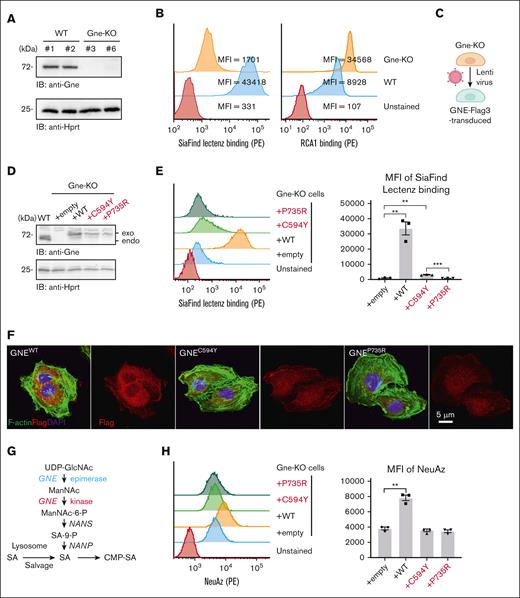 Both patient-derived GNE mutations severely affect de novo sialic acid biosynthesis. (A) Establishment of Gne-knockout mouse endothelial cell line MS1 validated by western blotting. Hprt, housekeeping protein. (B) Altered glycans on the cell surface of Gne-KO MS1 cells examined by flow cytometry using SiaFind Lectenz (pan-sialic acid probe) and RCA1 lectin (asialylated glycan lectin). The unstained control was used as a negative control. (C) Gne-KO MS1 cells were lentivirally infected with empty control or each GNE-Flag3 variant. (D) Expression analysis of each GNE protein by western blotting. Exogenously transduced GNE (exo) and endogenous Gne (endo) are distinguished by size based on Flag3 tag on transduced GNE. WT, wild type. (E) Infected cells were analyzed for SiaFind Lectenz binding by flow cytometry. (F) Expression of cytoplasmic GNE was reduced in MS1 cells transduced with mutant GNE imaged by confocal microscopy. Flag3, Flag3-tagged GNE; DAPI, nuclear marker. (G) Two pathways of sialic acid biosynthesis. (H) ManNAz-derived NeuAz on cell surface glycans of cells that were metabolically labeled with ManNAz for 3 days. ∗∗P < .01; ∗∗∗P < .001.