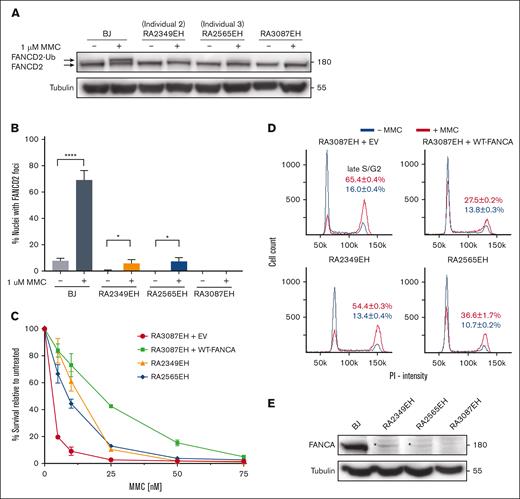 Functional evaluation of patient fibroblast cell lines shows hypomorphic nature of the c.3624C>T variant. (A) Western blot of the indicated cell lines with and without MMC treatment. Weak monoubiquitination of FANCD2 is observed in cells RA2349EH (from individual 2), and RA2565EH (from individual 3) in response to MMC. RA3087EH cells (individual with FA with biallelic deletions in FANCA) cells were used as negative controls. BJ cells were used as positive control. (B) Quantification of FANCD2 foci in the indicated cell lines. Proficiency of FANCD2 localization to sites of damage is suppressed in RA2349EH and RA2565EH in response to MMC but is higher than in FANCA-null cells (RA3087EH). Unpaired t test was used to test for significance between untreated and MMC-treated fibroblasts. Also see supplemental Figure 1. (C) Intermediate level of survival is observed for RA2349EH and RA2565EH cells in response to increasing concentrations of MMC. Cell survival was calculated relative to untreated cells. Error bars represent standard deviation (SD) of an experiment done in triplicate. Data from a representative experiment are shown with the SD showing the range of technical replicates. RA3087EH complemented with empty vector (EV) were used as a negative controls. RA3087EH complemented with wildtype FANCA (WT-FANCA) were used as a positive control. Statistical analysis was performed using data from 2 independent experiments, each with 3 technical replicates. Adjusted P values from multiple comparison 2-way analysis of variance analysis of differences in survival between RA3087EH+EV (FANCA null) and the other cell lines were P < .0001 at 5 and 10 nM of MMC for all 3 cell lines. P < .0001, P < .0057, and P < .0002 for WT, RA2349, and RA2565, respectively, at 25 nM MMC. At 50 nM MMC, the P value was significant (P < .0001) for the WT cell line only. (D) Cell cycle analysis without MMC treatment (blue line) or after exposure to 25 nM MMC (red line) in the indicated cell lines. Three independent experiments were performed and the average percentages of cells in the late S/G2 cell cycle stage are indicated. (E) Western blot analysis of FANCA in the indicated cell lines. RA2349EH and RA2565EH cells showed expression of residual endogenous FANCA protein (indicated by an asterisk “∗”).