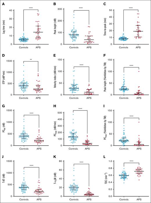TG and TD parameters in the patients with APS (n = 33) and control participants (n = 62) in the neural network clinical validation cohort. (A-F) The TG lag time (A) and time-to-peak (C) were significantly prolonged in patients with APS, whereas the peak height (B), ETP (D), velocity index (E), and the effect of TM on the peak height were reduced (F); and time-to-peak (C) did not differ significantly between patients with APS and controls on VKA treatment; the ETP (D) was significantly lower in patients with APS than controls, whereas the velocity index (E) was significantly higher. (F) The inhibitory effect of TM was significantly less in patients with APS compared with controls. (G-K) TD parameters PCtot (G), T-AT complex formation (J), and T-α2M formation (K) were significantly lower in patients with APS. (H) PCmax was significantly decreased in patients with APS, and the PCmax was less sensitive to the inhibitory actions of TM (I). (L) The thrombin decay capacity was significantly higher in patients with APS than controls. Differences between group means were analyzed using the Mann-Whitney test. ∗P < .05; ∗∗∗P < .001; ∗∗∗∗P < .0001. Data are shown as median and interquartile ranges.