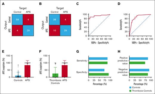 The validation of neural network NN01 in patients with APS (n = 33), controls (n = 62), and thrombosis controls (n = 38). (A-B) Confusion matrices showing the accuracy of diagnosis in patients with APS compared with an anticoagulated control cohort (A) and a thrombosis control cohort (B). (C-D) ROC curves of the diagnostic accuracy of NN01 to identify patients with APS from an anticoagulated control cohort (C) and a thrombosis control cohort (D). (E-F) Quantification of APS suspicion by NN01 according to subject type in anticoagulated controls (E) and thrombosis controls (F). (G) Quantified sensitivity and specificity of NN01 for the diagnosis of APS. (H) Positive and negative predictive values of NN01.