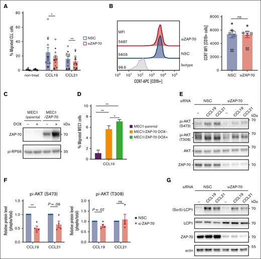 ZAP-70 enhances CCR7 signaling and chemotaxis. (A) Migration capacity in response to chemokine CCL19 or CCL21 (1 μg/mL, 3 hours) were quantified in primary CLL cells (n = 11) transfected with nonspecific siRNA or ZAP-70 siRNA. Percentage of migrated CLL cells were quantified by using counting beads and divided numbers of migrated CD5+ CD19+ cells through transwells by total cell numbers that were loaded onto transwells. Nontreated controls were the samples that were cultured in media without chemokines. (B) Representative fluorescence-activated cell sorter histograms (left) and quantification (right, n = 6) of surface CCR7 levels on CD19+ cells in primary CLL cells transfected with nonspecific siRNA or ZAP-70 siRNA. (C) ZAP-70 immunoblots of whole-cell lysates from MEC1/parental or MEC1/ZAP-70 cells. Cells were treated with doxycyline (1 μg/mL) for 72 hours as indicated. (D) Migration capacity in response to chemokine CCL19 (1 μg/mL, 3 hours) was quantified in MEC1/parental cells or MEC1/ZAP-70 cells treated with 1 μg/mL doxycycline. Percentage of migrated MEC1 cells were quantified using counting beads and numbers of migrated CD19+ cells through transwells were divided by total input cells numbers. (E) Phospho-AKT (T308), phospho-AKT (S473), total AKT, and ZAP-70 immunoblots of primary CLL cells after nonspecific control siRNA or ZAP-70 siRNA transfection. For cytokines stimulated samples, cultured CLL cells were treated with CCL19 or CCL21 at 1 μg/mL for 5 minutes. (F) Graphs of relative phosphorylated AKT level (relative to total AKT levels) in CLL samples transfected with control siRNA or ZAP-70 siRNA and treated with CCL19 or CCL21 at 1 μg/mL for 5 minutes. (G) Phospho-LCP1 (S5), total LCP1, ZAP-70, and β-actin immunoblots of primary CLL cells after nonspecific control siRNA or ZAP-70 siRNA transfection. For cytokines stimulated samples, cultured CLL cells were treated with CCL19 or CCL21 at 1 μg/mL for 5 minutes (n = 3). Statistical significance between samples was assessed by paired 2-tailed Student t tests. ∗P < 5 × 10−2; ∗∗P < 10−3. ns, not significant.