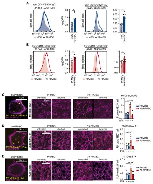 Cd79b p.Y195H augments BCR signaling. (A) Lymphoma cells of MBC and 79-MBC lymphomas were analyzed for levels of phosphorylated PLCg2 and SYK by flow cytometry. Representative cases are visualized as histograms, the geometric mean fluorescence intensity (MFI) is quantified for all analyzed cases (MBC, n = 10; and 79-MBC, n = 7). (B) The levels of phosphorylated PLCg2 and SYK in PPMBC and 79-PPMBC lymphoma cells were determined by flow cytometry. Visualized are representative cases; the MFIs of 12 PPMBC and 18 79-PPMBC lymphoma samples were quantified. (C) PLAs to detect the proximity of MYD88 and CD79B were performed on FFPE samples of PPMBC and 79-PPMBC lymphomas. Before sample collection, the animals were either left untreated or treated acutely with ibrutinib (30mg/kg orally, daily for 3 days). PLA foci are visualized in yellow, and B220 staining (violet) was used to determine cell numbers. The PLA count per cell was quantified for a minimum of 5 independent lymphomas per condition. PLAs were performed in a similar manner to detect the proximity of MYD88 with MALT1 (D) and BTK (E). ∗P ≤ .05, ∗∗P ≤ .01, ∗∗∗P ≤ .001, ∗∗∗∗P ≤ .0001. Welch's 2-tailed t test, Benjamini-Hochberg-correction for multihypothesis testing. APC, allophycocyanin; FFPE, formalin-fixed, paraffin-embedded.